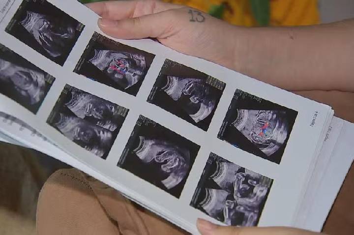 Gestante que perdeu bebê denuncia falta de atendimento no CHS de Sorocaba