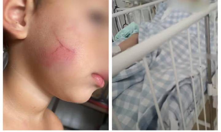 Polícia procura babá suspeita de agredir bebê em Sorocaba