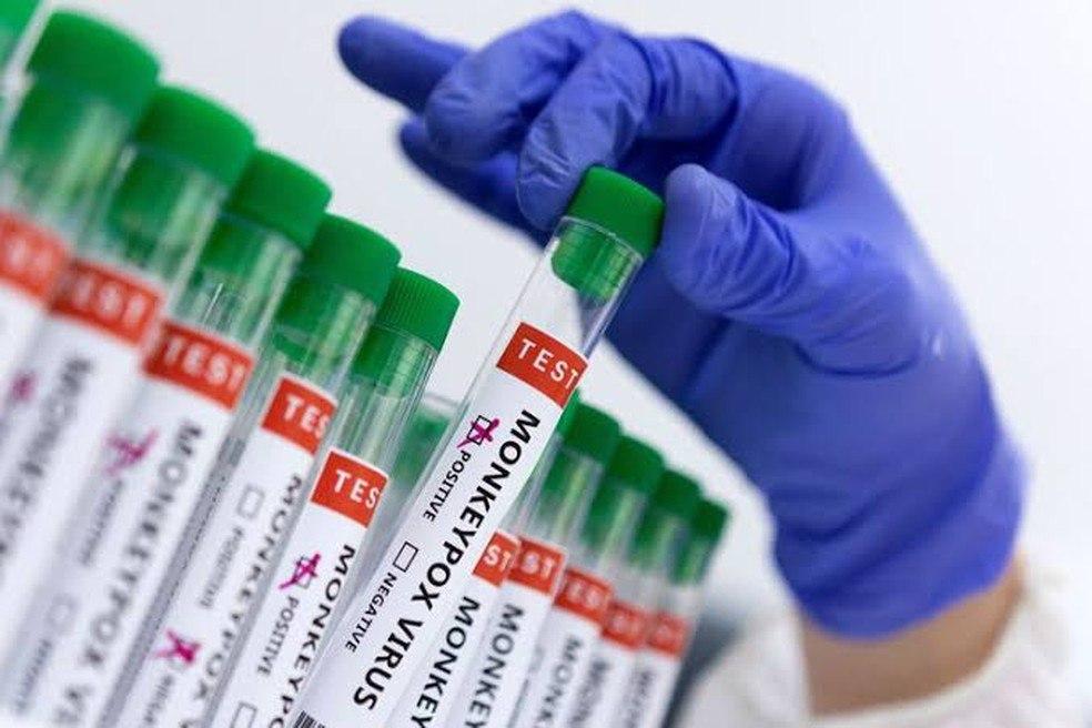 Jundiaí confirma mais um caso de varíola dos macacos nesta quarta-feira