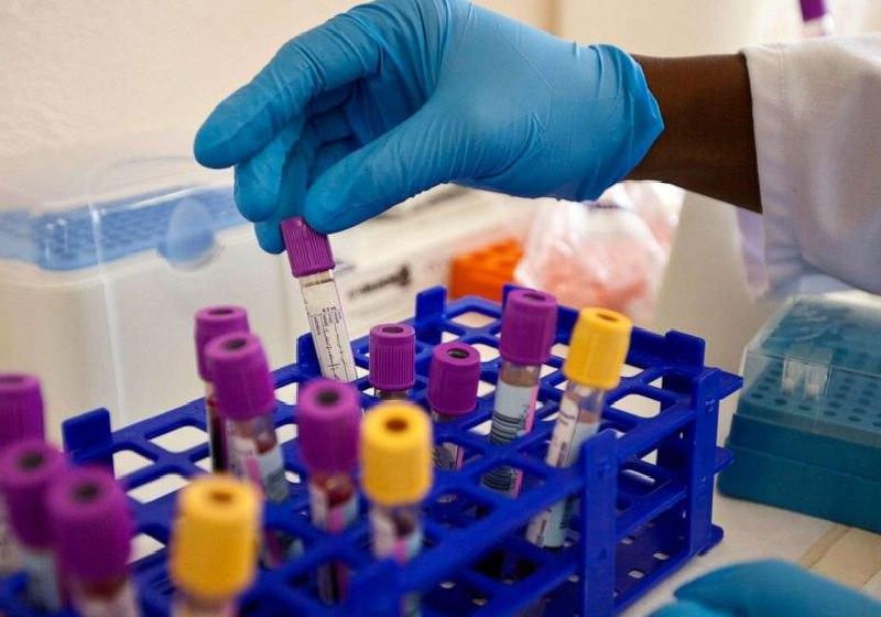 5ª pessoa é curada do HIV. Fez transplante de células-tronco