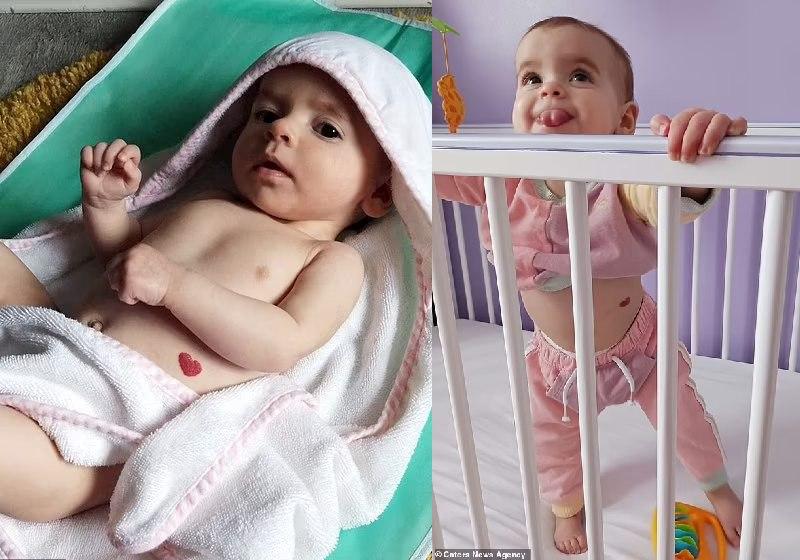Bebê nasce com marca em forma de coração e surpreende a todos.