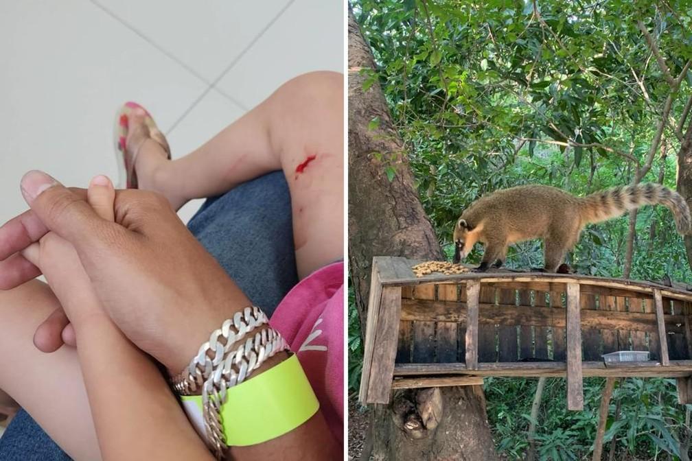 Criança de Três Anos é Mordida por Quati em Sorocaba