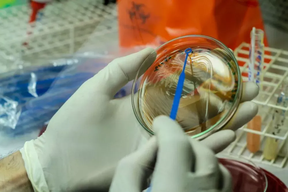 Jundiaí confirma primeiro caso de mpox em 2024