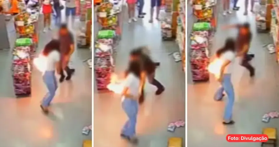 Celular explode no bolso e jovem sofre queimaduras em Anápolis