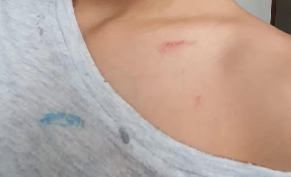 Justiça determina indenização para aluno autista agredido em escola de Sorocaba