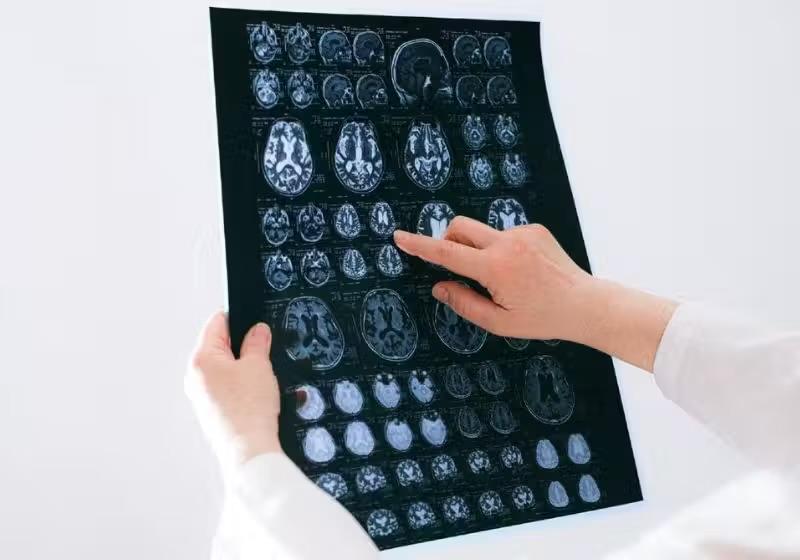 Cientistas revertem sintomas do Parkinson em camundongos com nova abordagem