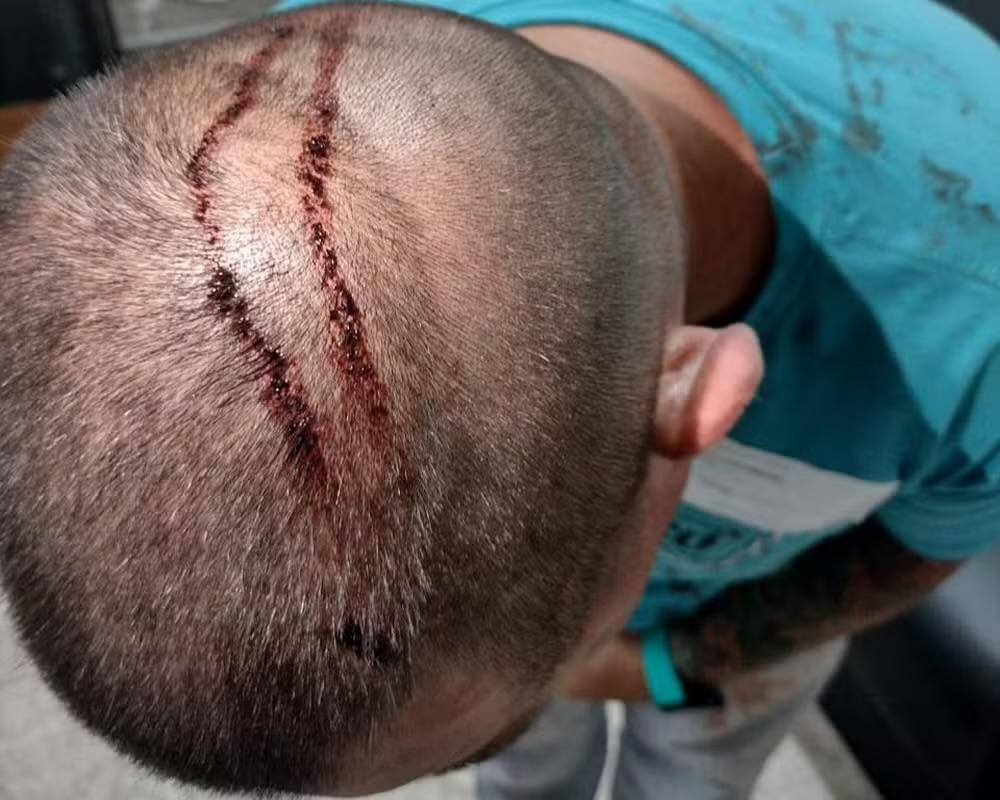 Homem é preso após tentar matar conhecido com golpes de facão em Tietê