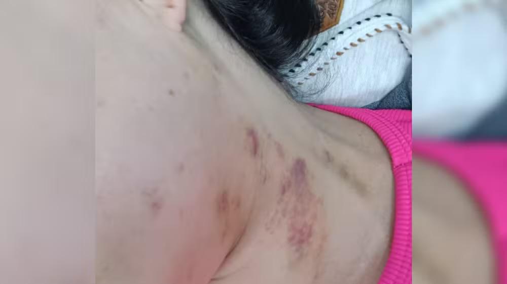 Mulher tem tímpano perfurado após agressão do ex e denuncia negligência policial em Itapetininga
