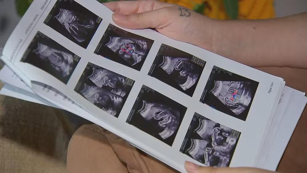 Gestante que perdeu bebê denuncia falta de atendimento no CHS de Sorocaba