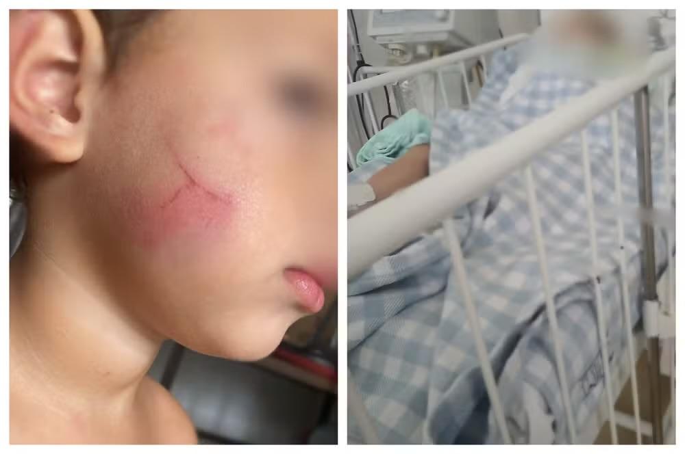 Polícia procura babá suspeita de agredir bebê em Sorocaba