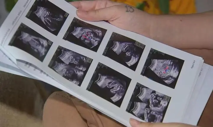Gestante que perdeu bebê denuncia falta de atendimento no CHS de Sorocaba