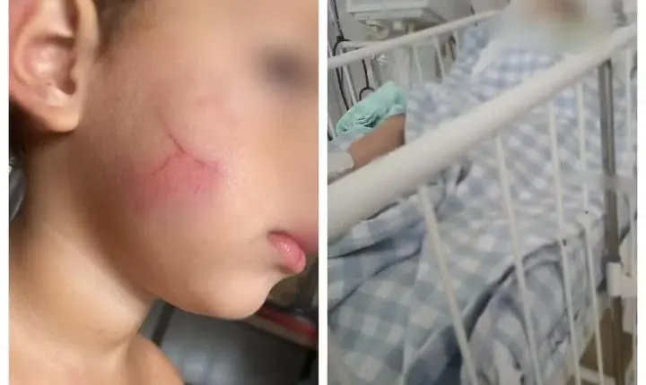 Polícia procura babá suspeita de agredir bebê em Sorocaba